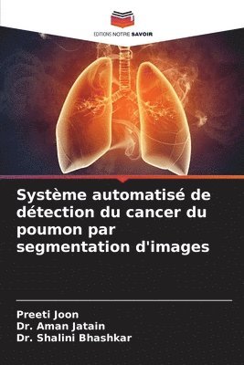 Systme automatis de dtection du cancer du poumon par segmentation d'images 1