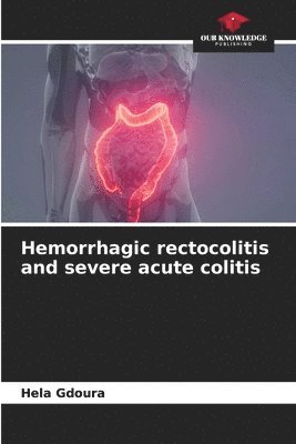 bokomslag Hemorrhagic rectocolitis and severe acute colitis