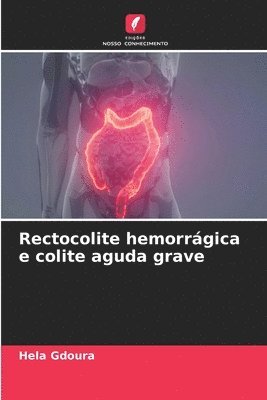 bokomslag Rectocolite hemorrgica e colite aguda grave