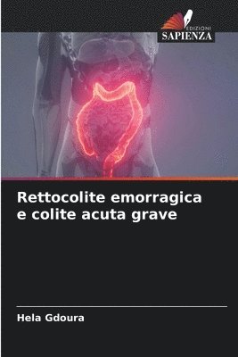 bokomslag Rettocolite emorragica e colite acuta grave