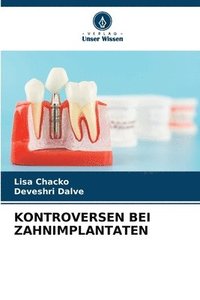 bokomslag Kontroversen Bei Zahnimplantaten