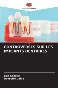 bokomslag Controverses Sur Les Implants Dentaires