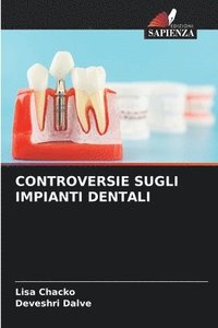 bokomslag Controversie Sugli Impianti Dentali