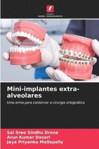 bokomslag Mini-implantes extra-alveolares