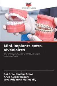 bokomslag Mini-implants extra-alvolaires