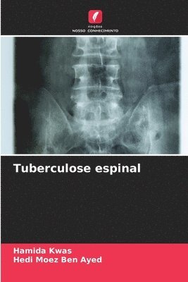 Tuberculose espinal 1