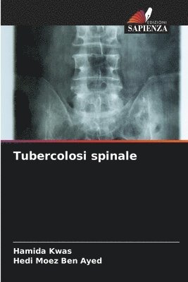 Tubercolosi spinale 1