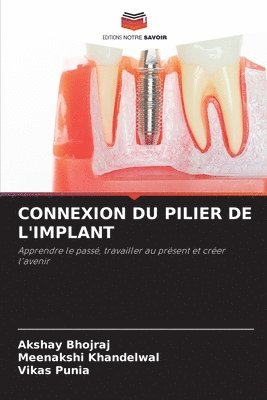 Connexion Du Pilier de l'Implant 1