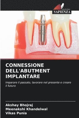 bokomslag Connessione Dell'abutment Implantare