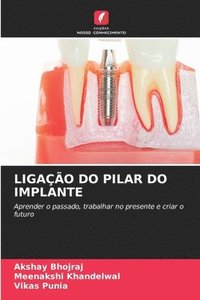 bokomslag Ligao Do Pilar Do Implante