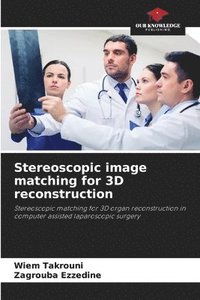 bokomslag Stereoscopic image matching for 3D reconstruction