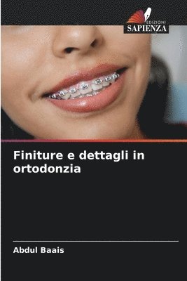 bokomslag Finiture e dettagli in ortodonzia