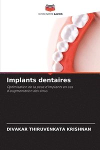 bokomslag Implants dentaires