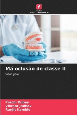 M ocluso de classe II 1