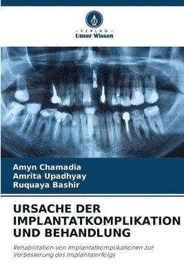 Ursache Der Implantatkomplikation Und Behandlung 1