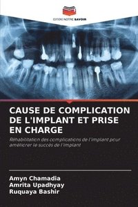 bokomslag Cause de Complication de l'Implant Et Prise En Charge