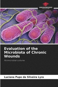 bokomslag Evaluation of the Microbiota of Chronic Wounds