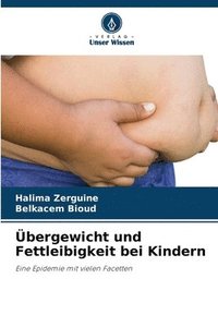 bokomslag bergewicht und Fettleibigkeit bei Kindern