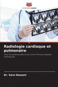 bokomslag Radiologie cardiaque et pulmonaire