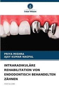 bokomslag Intraradikulre Rehabilitation Von Endodontisch Behandelten Zhnen