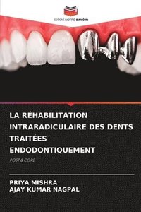 bokomslag La Rhabilitation Intraradiculaire Des Dents Traites Endodontiquement