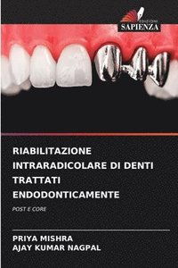 bokomslag Riabilitazione Intraradicolare Di Denti Trattati Endodonticamente
