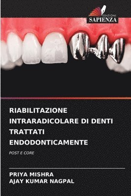 Riabilitazione Intraradicolare Di Denti Trattati Endodonticamente 1