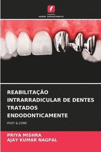 bokomslag Reabilitao Intrarradicular de Dentes Tratados Endodonticamente