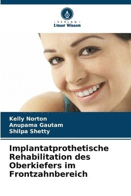 Implantatprothetische Rehabilitation des Oberkiefers im Frontzahnbereich 1