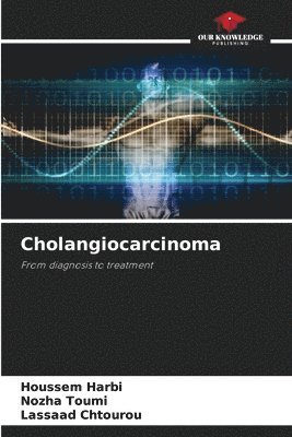 Cholangiocarcinoma 1