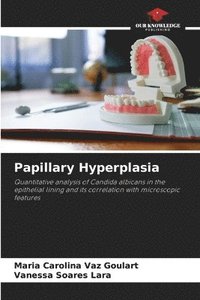 bokomslag Papillary Hyperplasia