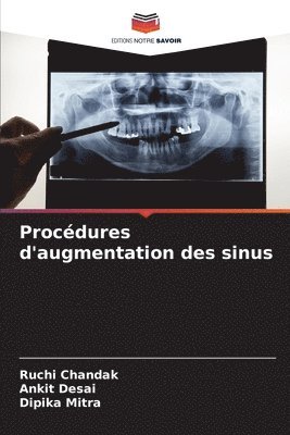 Procdures d'augmentation des sinus 1