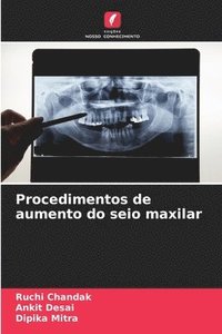 bokomslag Procedimentos de aumento do seio maxilar