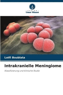 Intrakranielle Meningiome 1