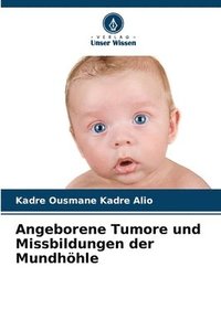 bokomslag Angeborene Tumore und Missbildungen der Mundhhle