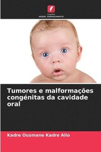 bokomslag Tumores e malformaes congnitas da cavidade oral
