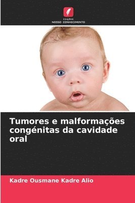 Tumores e malformaes congnitas da cavidade oral 1