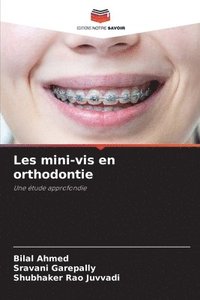 bokomslag Les mini-vis en orthodontie