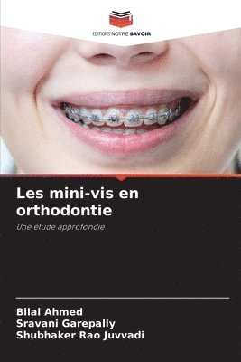 Les mini-vis en orthodontie 1