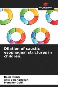 bokomslag Dilation of caustic esophageal strictures in children.