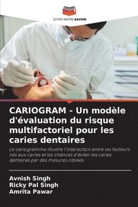 bokomslag CARIOGRAM - Un modle d'valuation du risque multifactoriel pour les caries dentaires
