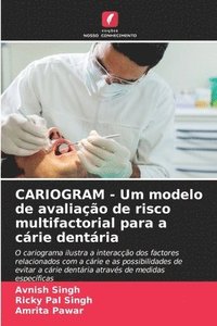 bokomslag CARIOGRAM - Um modelo de avaliao de risco multifactorial para a crie dentria