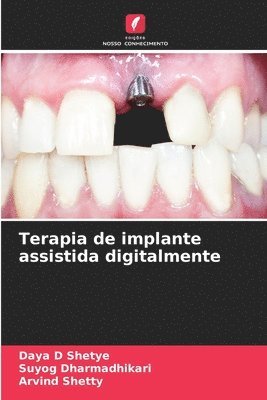 Terapia de implante assistida digitalmente 1