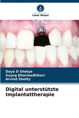 Digital untersttzte Implantattherapie 1