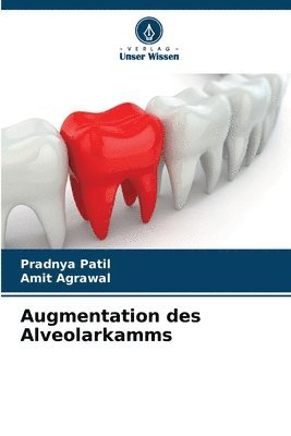 Augmentation des Alveolarkamms 1
