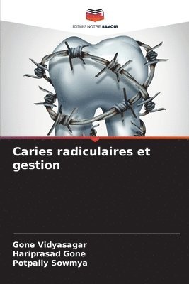 Caries radiculaires et gestion 1