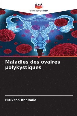 Maladies des ovaires polykystiques 1