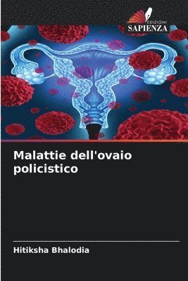 Malattie dell'ovaio policistico 1