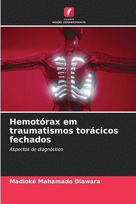 Hemotrax em traumatismos torcicos fechados 1