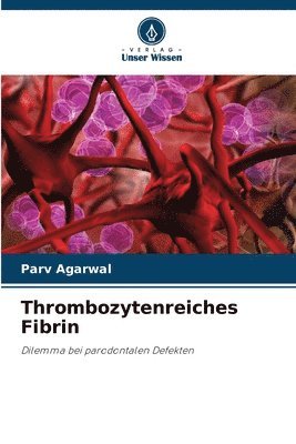 Thrombozytenreiches Fibrin 1